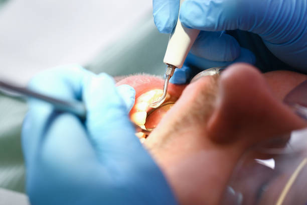 Best Emergency Root Canal Therapy in Baker, MT
