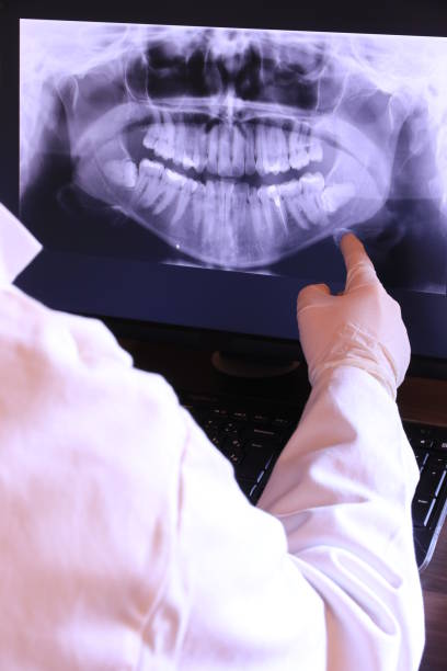 Best Broken or Chipped Tooth Repair in Baker, MT