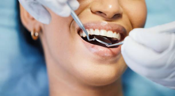 Best Dental Abscess Treatment in Baker, MT