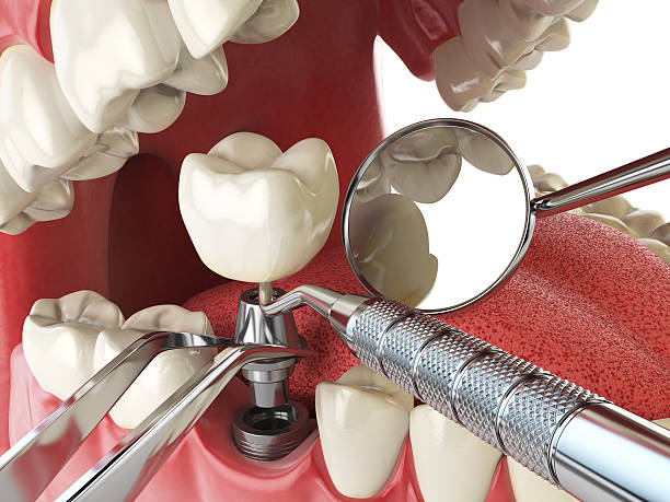 Best Emergency Treatment for Oral Infections in Baker, MT